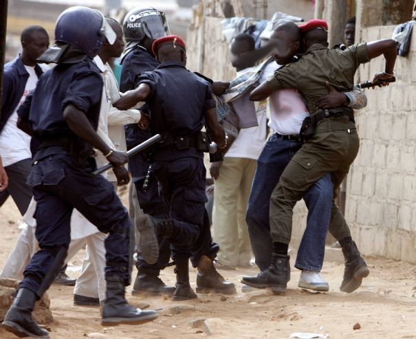 Arame Fall, victime collatérale des heurts de Touba : "C'est un policier qui m'a tiré dessus"